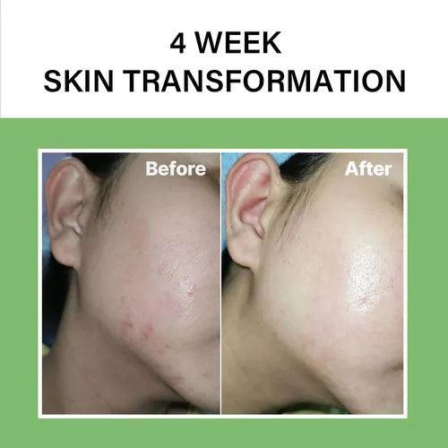 Celimax Noni ampoule